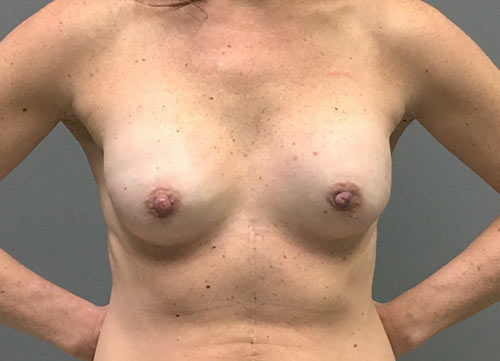 After Image